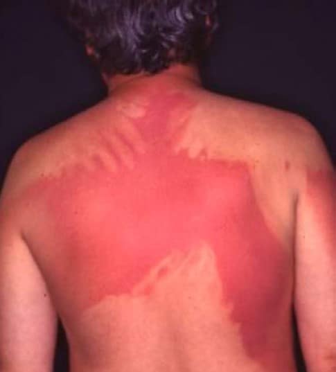 EURO COSMETICS Magazine • Do Sunscreens work? Of course they do … • Uli Osterwalder • Uli Osterwalder