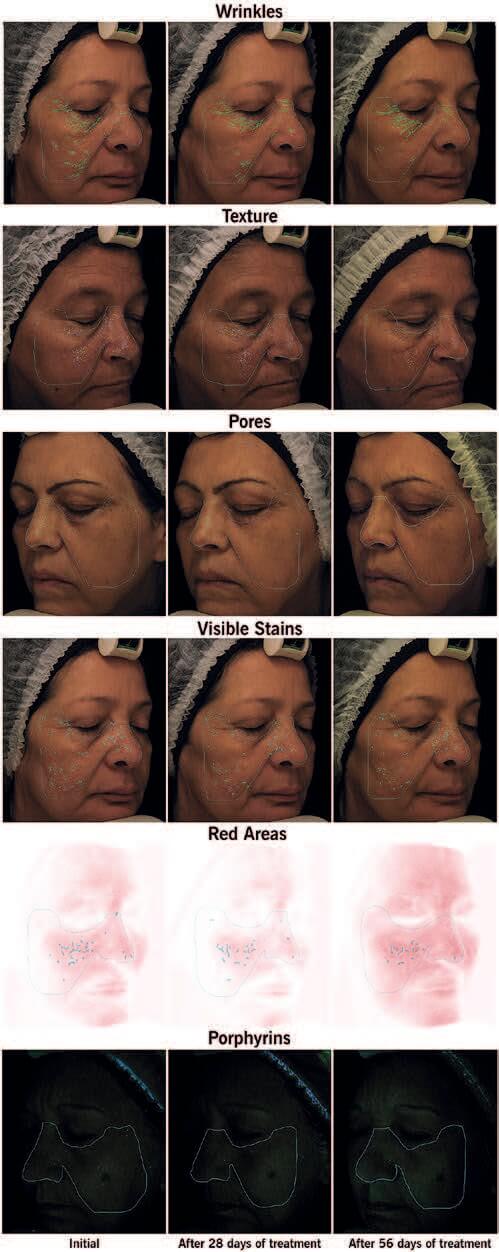 EURO COSMETICS Magazine • Plant-derived Peptides and Biotechnology • Ò. Expósito and M. Buchholz • Ò. Expósito and M. Buchholz