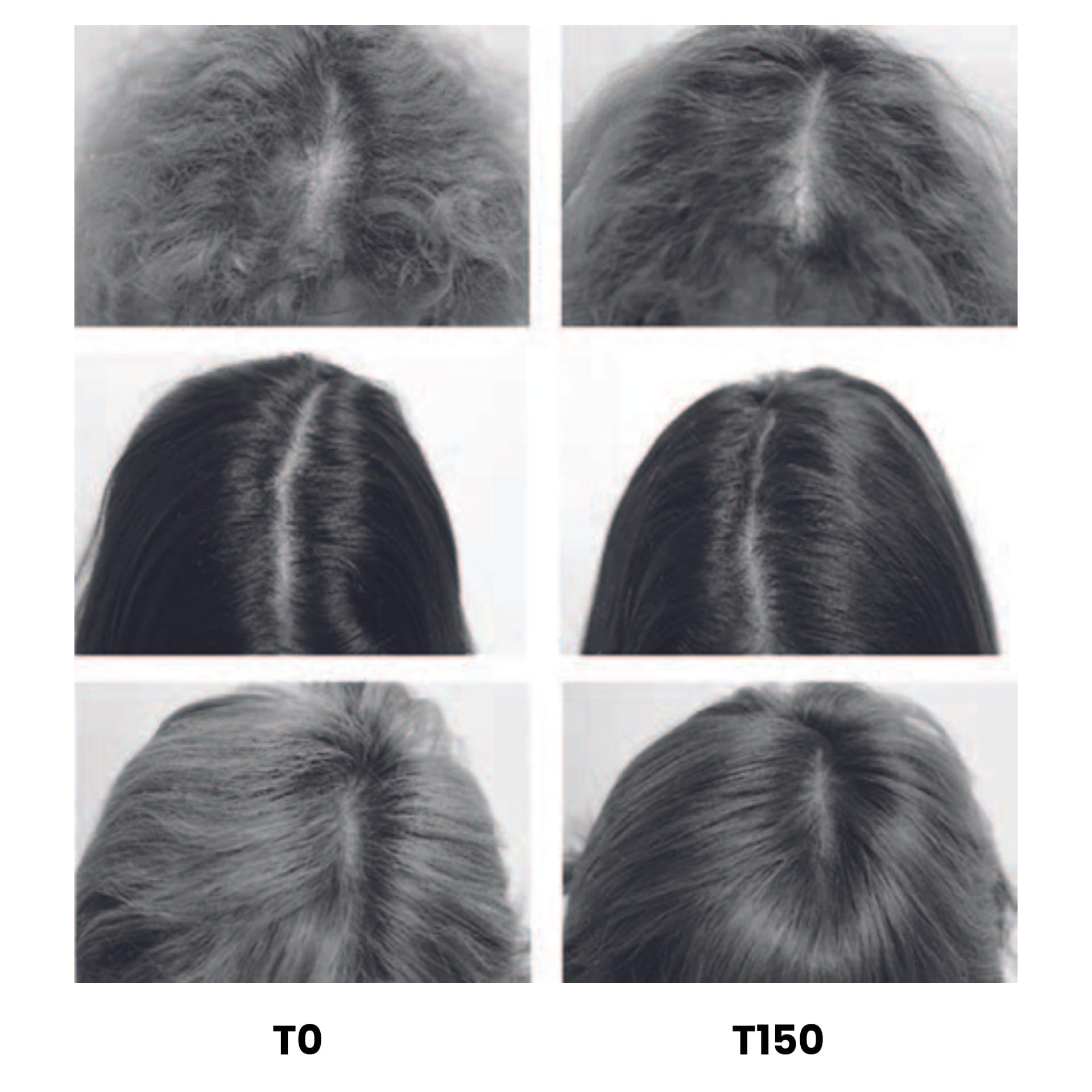 EURO COSMETICS Magazine • Preliminary Observations of the Effects of a Curcuma longa and Niacinamide-led Formulain the Reduction of Hair Loss • Anders Reckendorff • Anders Reckendorff