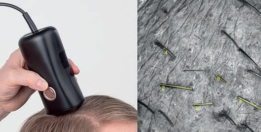 EURO COSMETICS Magazine • Is hair care the new skin care? • C. Uhl, D. Khazaka and A. Pouladi • C. Uhl, D. Khazaka and A. Pouladi
