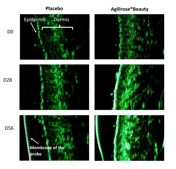 EURO COSMETICS Magazine • Redensify, Rehydrate, Rejuvenate: Clinical Insights on AGILIROSE® BEAUTY • Cynthia G. Suárez Rizzo • Cynthia G. Suárez Rizzo